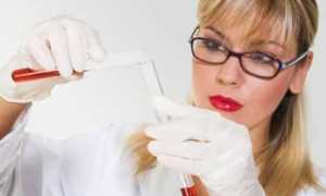 Норма сахара в крови у ребенка