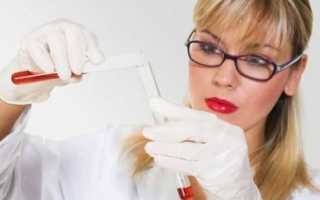 Норма сахара в крови у ребенка