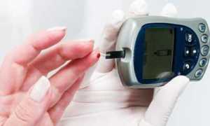 Сахарный диабет 2 типа: диагностика, лечение и диета