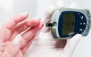 Сахарный диабет 2 типа: диагностика, лечение и диета