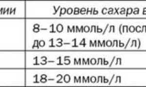 Симптомы сахарного диабета у женщин