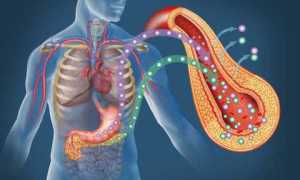 Инсулинорезистентность как предвестник диабета второго типа и ее связь с поликистозом яичников