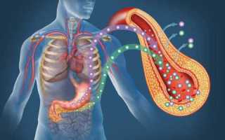 Инсулинорезистентность как предвестник диабета второго типа и ее связь с поликистозом яичников