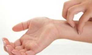 Зуд и кожные проявления при диабете