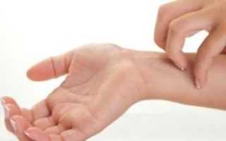 Зуд и кожные проявления при диабете