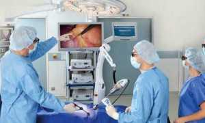 Проявления и развитие панкреатита после холецистэктомии