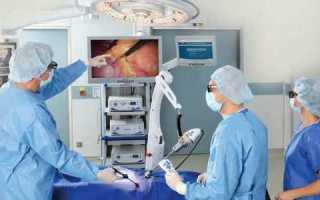 Проявления и развитие панкреатита после холецистэктомии