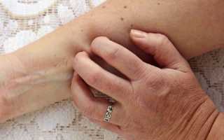 Изменения кожных покровов при панкреатите