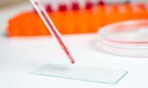 Как сдать кровь на инсулин правильно