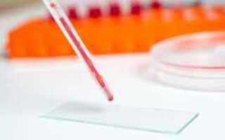 Как сдать кровь на инсулин правильно