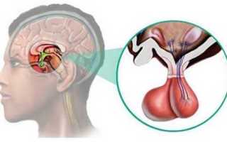Что такое пролактинома у мужчин и женщин, ее признаки и методы лечения