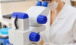 Изменения кала при развитии панкреатита