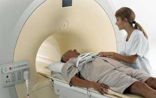 Как делают МРТ головного мозга, и можно ли его делать с металлическими коронками?