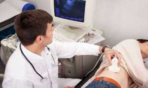 Что такое реактивные изменения поджелудочной железы