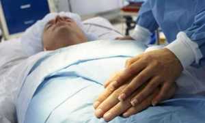 Асцит при циррозе печени