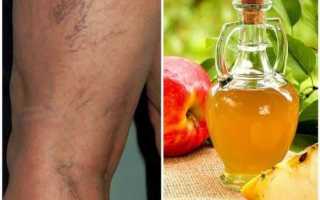 Яблоки при сахарном диабете