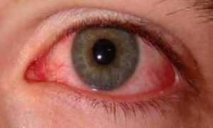 Как сахарный диабет влияет на зрение и заболевания глаз