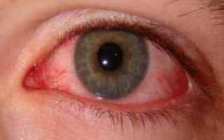 Как сахарный диабет влияет на зрение и заболевания глаз