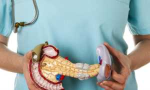 Зачем нужна дифференциальная диагностика при панкреатите?