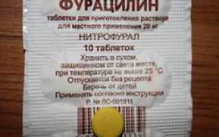 Приготовление и полоскание горла раствором Фурацилина при ангине