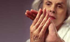 Ревматоидный диабетический артрит: что делать, если болят суставы?