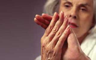 Ревматоидный диабетический артрит: что делать, если болят суставы?