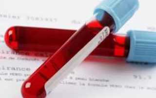 Что такое гликированный сахар как сдавать данный анализ