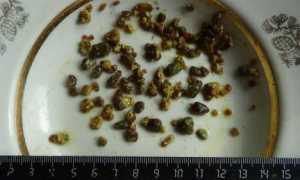 Камни в поджелудочной железе