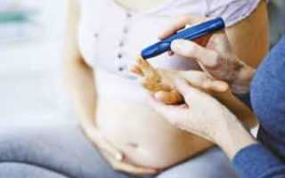 Признаки и опасности гестационного сахарного диабета
