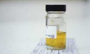 Запах ацетона в моче у взрослого человека