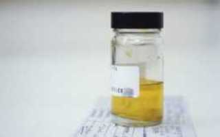 Запах ацетона в моче у взрослого человека