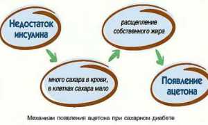 Диабетическая (сахарная) кома