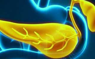 Классификация хронической формы панкреатита