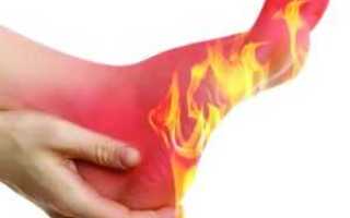 Причины жжения в ногах при диабете