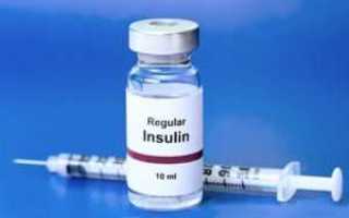 Инсулинотерапия при сахарном диабете 1 типа