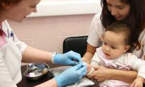 Норма сахара в крови у детей: удостоверься в здоровье малыша