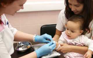 Норма сахара в крови у детей: удостоверься в здоровье малыша