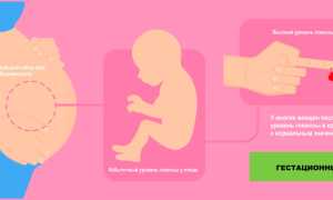 Гестационный сахарный диабет диабет у беременных