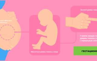 Гестационный сахарный диабет диабет у беременных