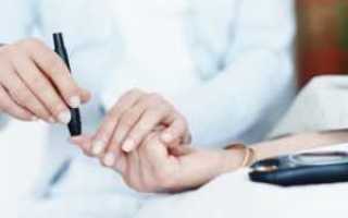 Что такое гиперинсулемия и причины ее развития