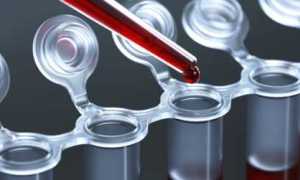 Какова норма инсулина в крови и зачем сдают анализы ГТГС и АТ к инсулину?