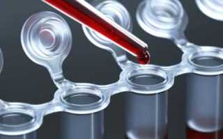 Какова норма инсулина в крови и зачем сдают анализы ГТГС и АТ к инсулину?