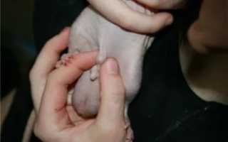 Приросла кожа к головке