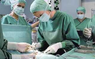 Хирургия при хроническом панкреатите: показания к операциям и виды операций