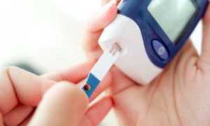 Диабет 2 типа и не только: диагностическая норма сахара в крови и правильное измерение гликемии