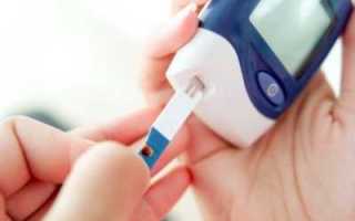 Диабет 2 типа и не только: диагностическая норма сахара в крови и правильное измерение гликемии
