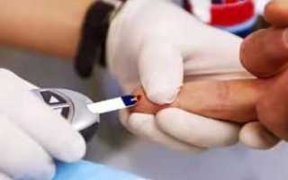 Сахар в крови от 24 до 24,9 ммоль/л что это значит