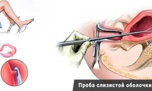 Пайпель биопсия: методы, показания и процедура