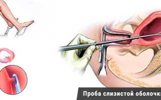 Пайпель биопсия: методы, показания и процедура