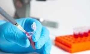 Высокий инсулин при нормальном показателе сахара